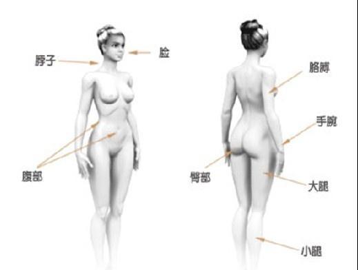分层吸脂示意图