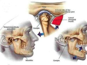 颞下颌关节紊乱综合征