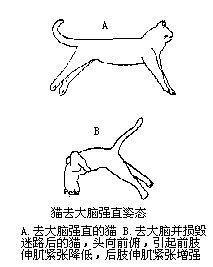 去大脑僵直