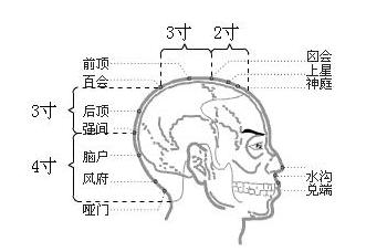 脑户