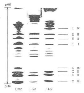 VLDL的IEF-PAGE图 VLDL的IEF-PAGE图