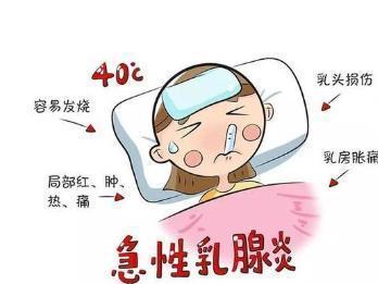 乳腺炎 搜狗百科