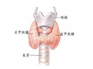 亚急性甲状腺炎