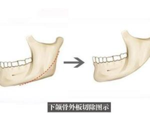 下颌骨