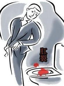肛裂出血