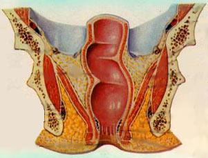 直肠瓣图片