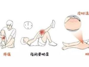 骨癌