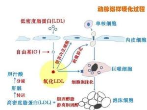 低密度脂蛋白