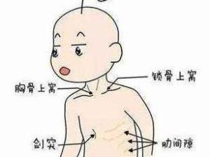 三凹征