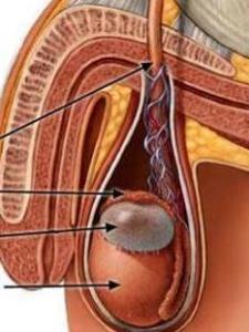 附睾囊肿自愈方法图片