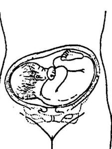 胎位头位顶先露有六种胎位:左枕前(loa) 左枕横(lot) 左枕后(lop) 右