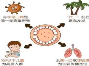 疱疹性咽峡炎