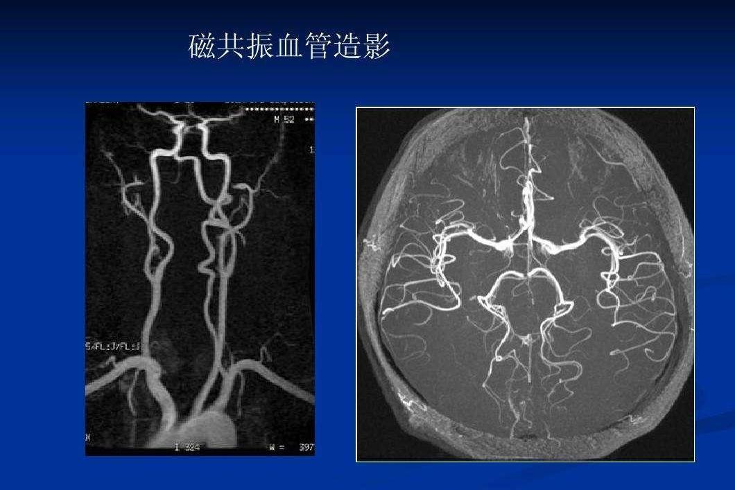 Mra 搜狗百科