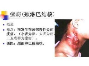 瘰疬_搜狗百科