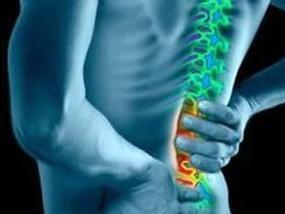 急性腰椎间盘突出