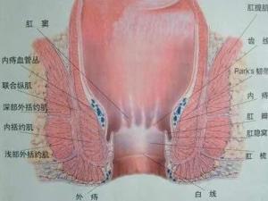 肛门肿痛
