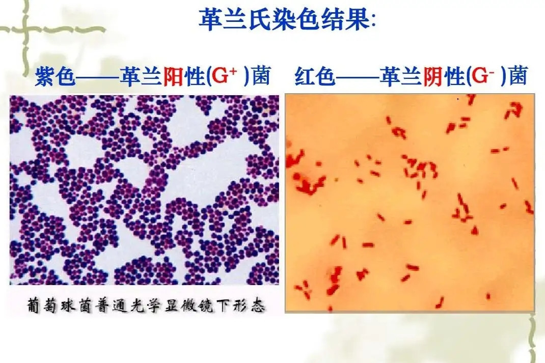 革兰染色 鉴别染色法 搜狗百科