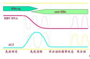 乙型肝炎自然史的4个时期模式图