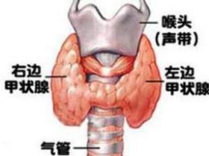 甲状腺功能亢进症