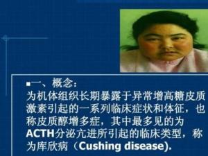 库欣综合征