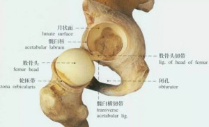 股骨頭