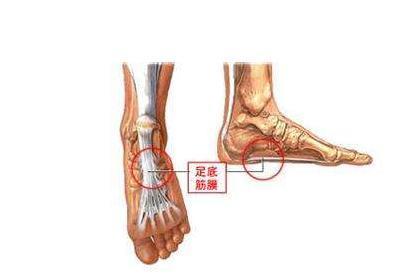 足底筋膜炎 搜狗百科 足底筋膜炎 搜狗百科