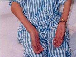 肌肉萎缩症 搜狗百科 肌肉萎缩症 搜狗百科
