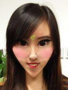 锥子脸