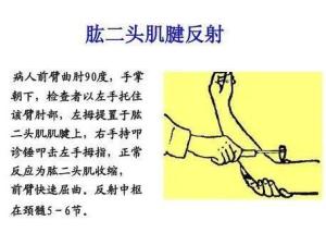 (1)肱二头肌腱反射近远端骨的肌腱位置上,用叩诊锤快速叩诊引出反射.