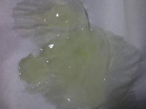精子不液化 搜狗百科 精子不液化 搜狗百科