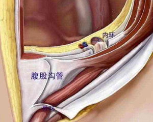 腹股沟内环和外环图片