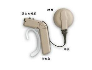 人工耳蜗