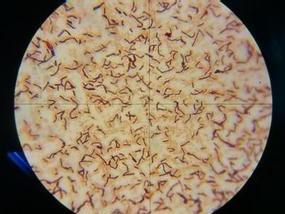 沙门菌显微镜图片