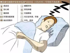 睡眠呼吸暂停低通气综合征