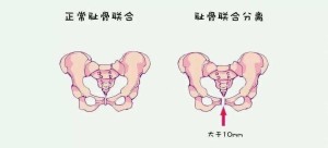 耻骨