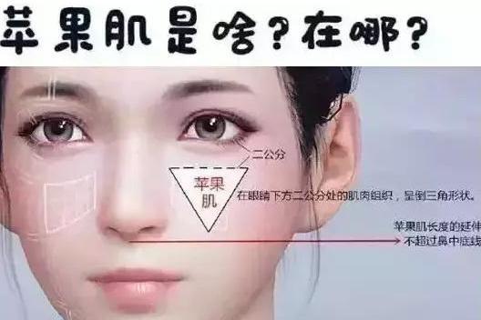苹果肌 颧骨前的脂肪组织 搜狗百科 苹果肌 颧骨前的脂肪组织 搜狗百科