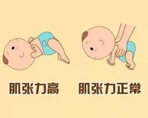 肌张力