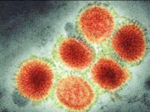 H1N1