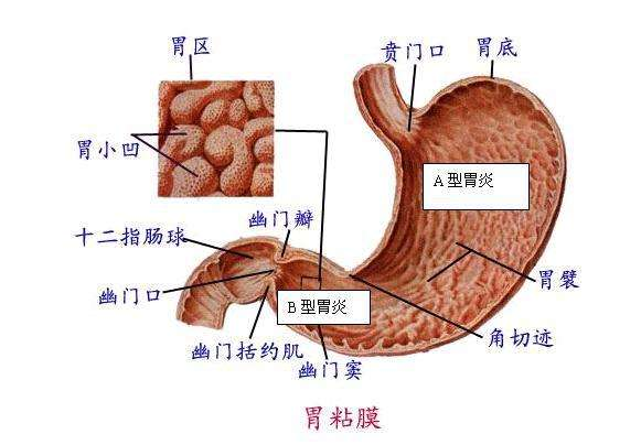 胃窦前壁图片