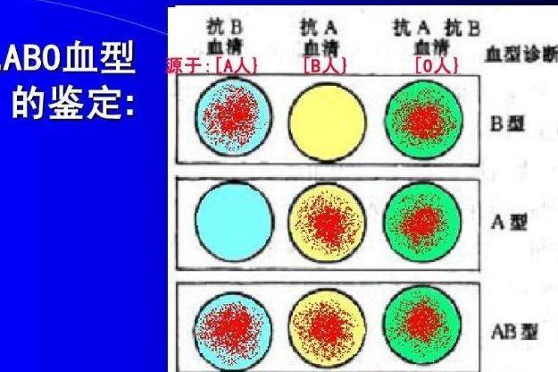 Abo血型鉴定 搜狗百科