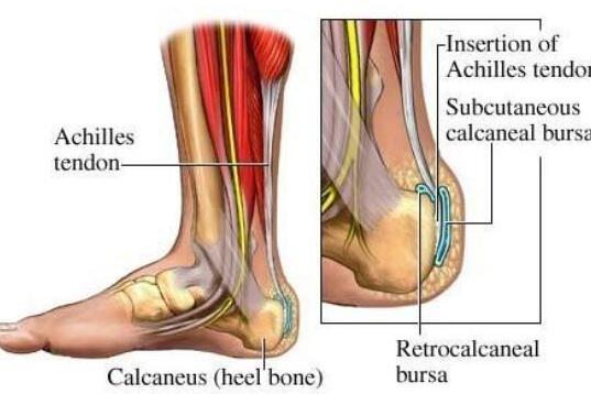 跟腱炎 搜狗百科