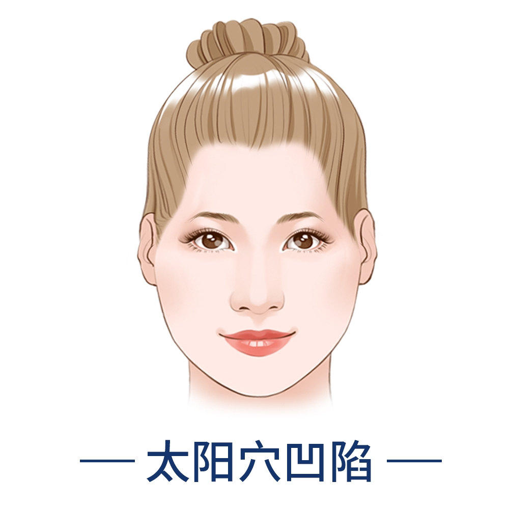 太阳穴