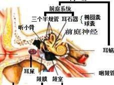 神经炎