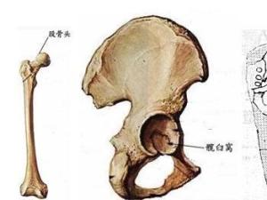 股骨头