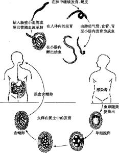 人蛔虫