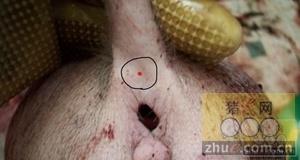 后海穴位置