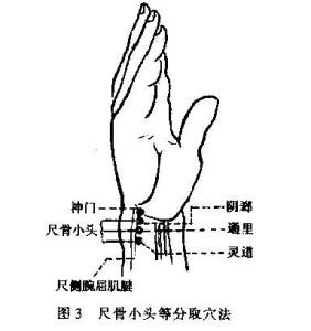 尺骨小头等分取穴