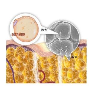 脂肪细胞手绘图图片