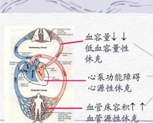 血容量 - 搜狗百科