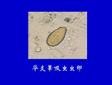 华支睾吸虫